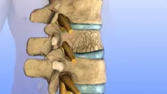 Backbone image